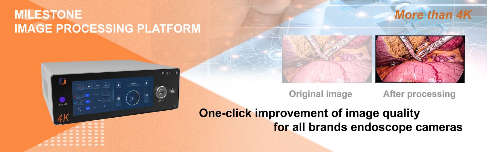 Medical Endoscope Camera