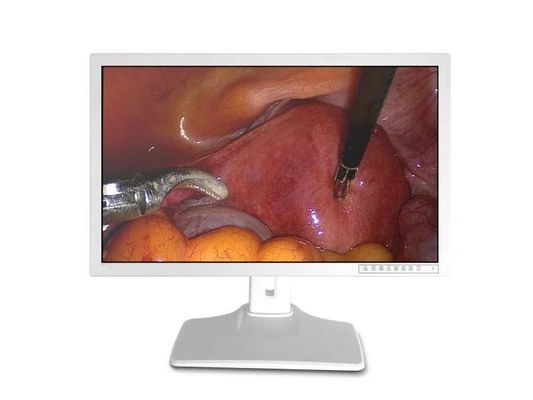 Medical Endoscopic Accessories Display 32inch