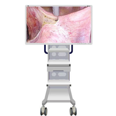 Medical Endoscope Monitor Camera With Screen 55inch