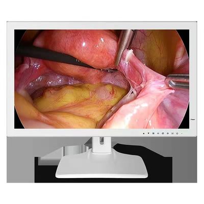 1980x1200 RGBS Endoscope Medical Monitor 24inch
