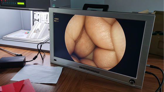 22 Inch Monitor Integrated ENT Full HD Endoscope Camera System Set Portable