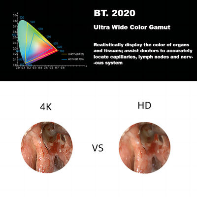 DEC 3840A New 4K Ultra HD Medical Endoscope Camera System For Laparoscopy